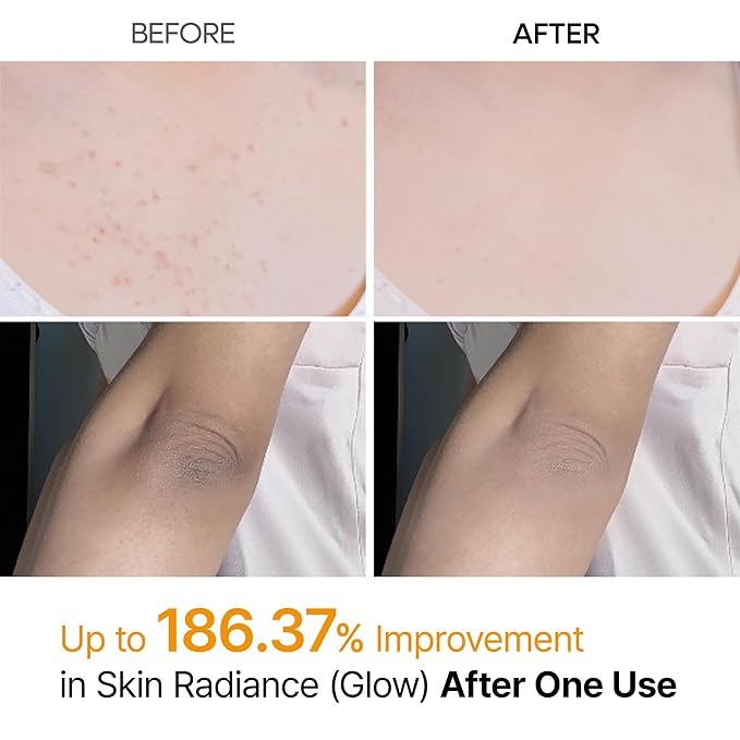 Dr. Melaxin Peel Shot kojic acid body spray 200ml product view 6