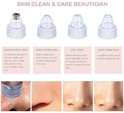 Pore vacuum cleaner with 5 suction levels product view 2