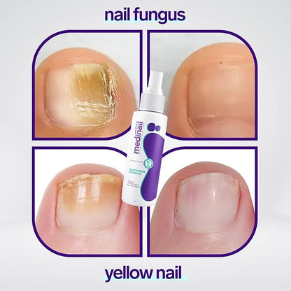 Jaysuin nail care spray 100ml product view 2