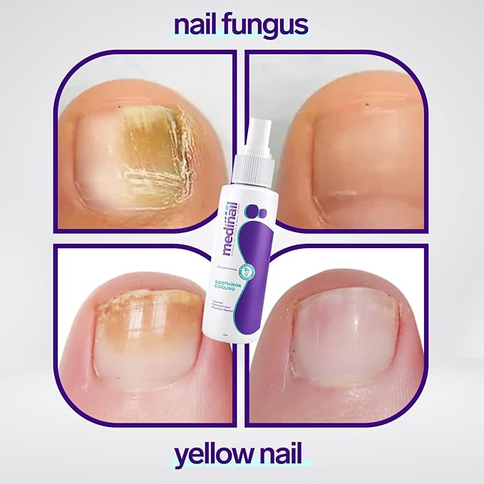 Jaysuin nail care spray 100ml product view 2