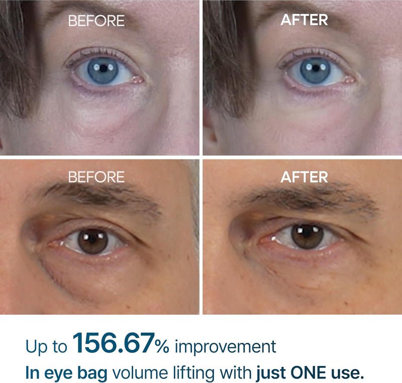 Dr. Melaxin Eyephlat eye cream 10ml product view 3