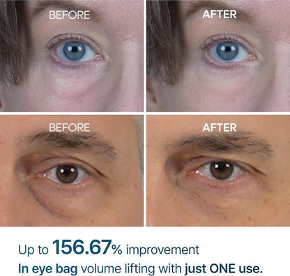 Dr. Melaxin Eyephlat eye cream 10ml product view 3
