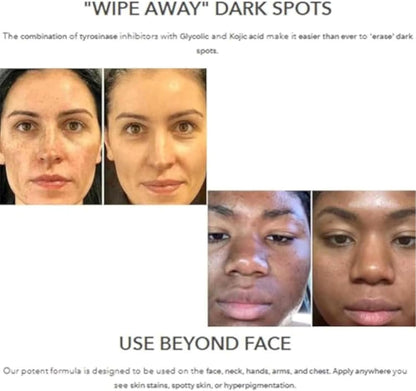 Dark spot corrector lotion 30ml product view 3