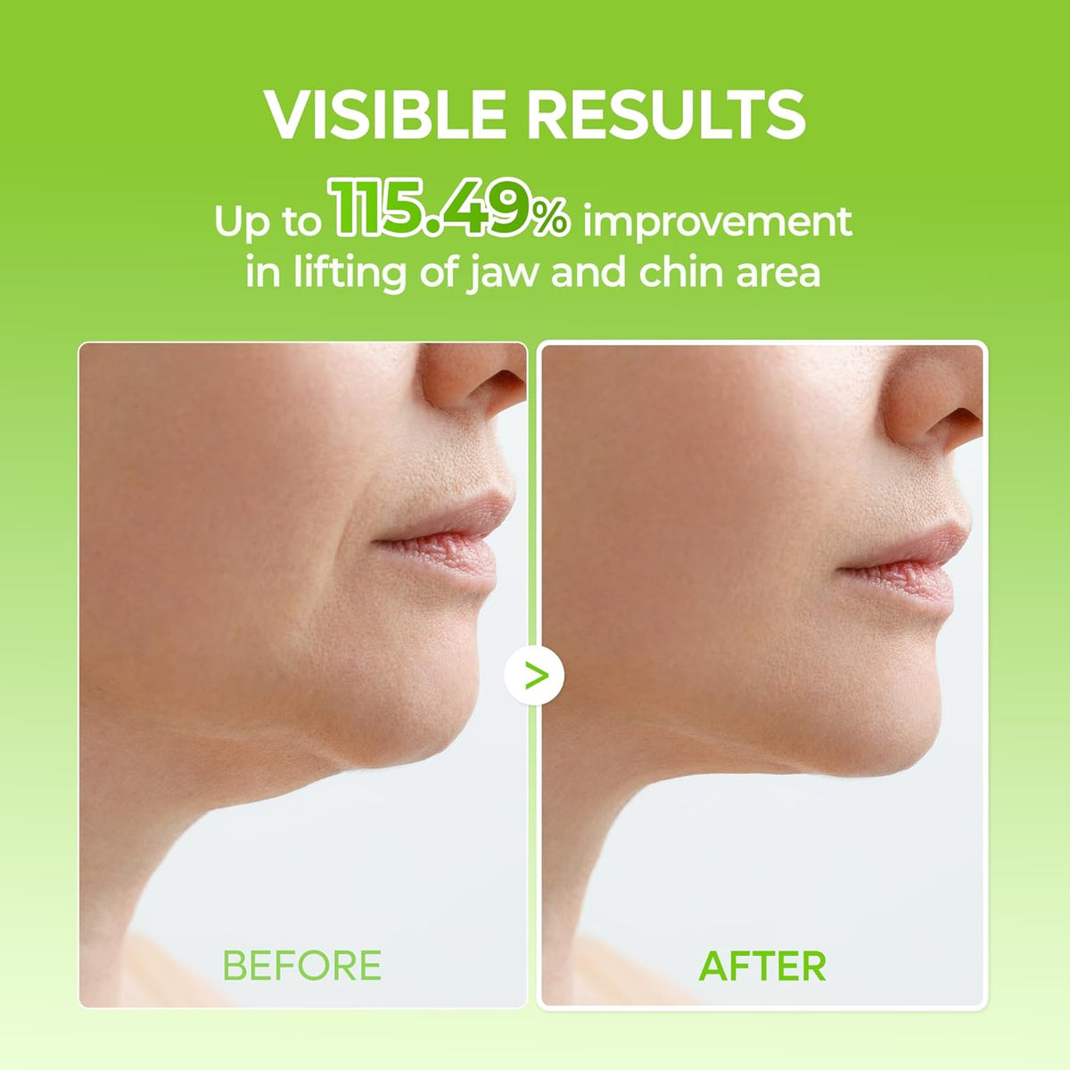 Dr. Melaxin CACTOX V-Lifting Band 4 masks product view 5