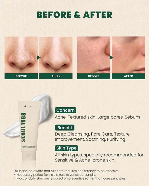 Seoul 1988 Pine Cica cleansing foam product view 5