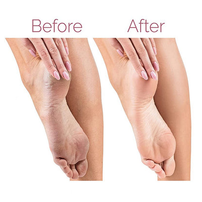 Electric foot file callus remover product view 5