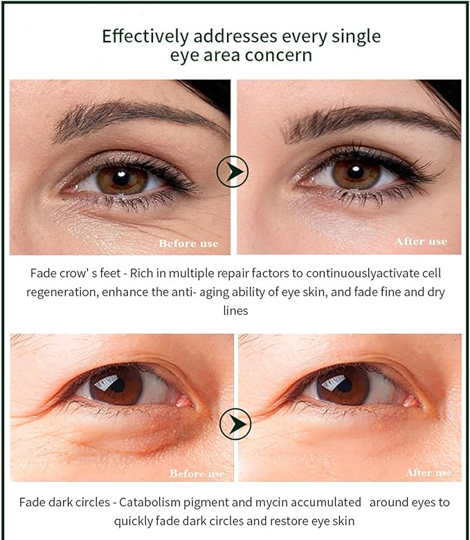 Time Eraser eye essence oil 10ml product view 6