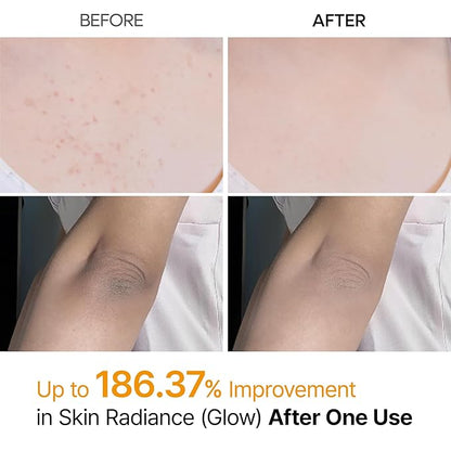Dr. Melaxin Peel Shot kojic acid body spray 200ml product view 6