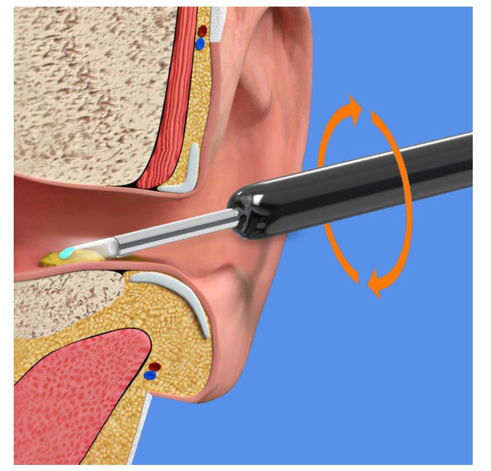 Earwax removal camera kit product view 6